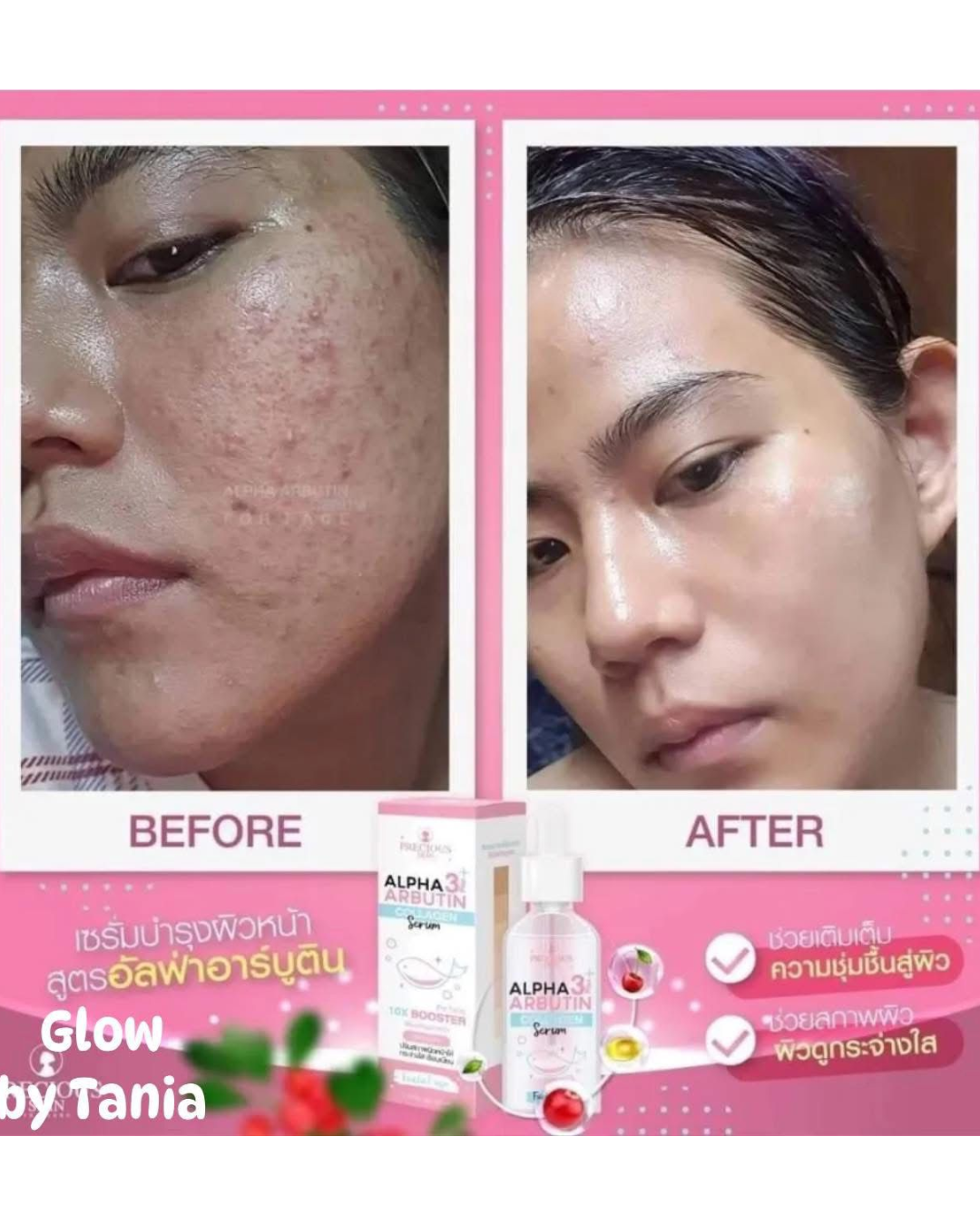 Precious Skin Alpha Arbutin 3 Plus Collagen Serum for Face - Image 4